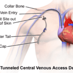 Cómo garantizar el acceso en el ámbito digital